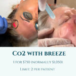 CO2 with Breeze 1 CO2 with Breeze