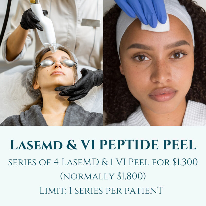 LaseMD & VI Peptide Peel